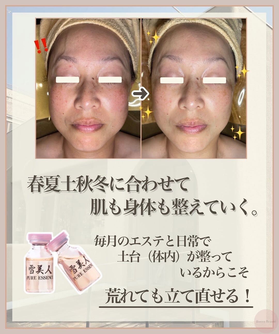 肌荒れから回復したビフォーアフター写真とともに、季節のリズムに合わせたケアで肌と身体を整えることの大切さを伝えるビジュアル。雪美人プラセンタのイメージもあり。