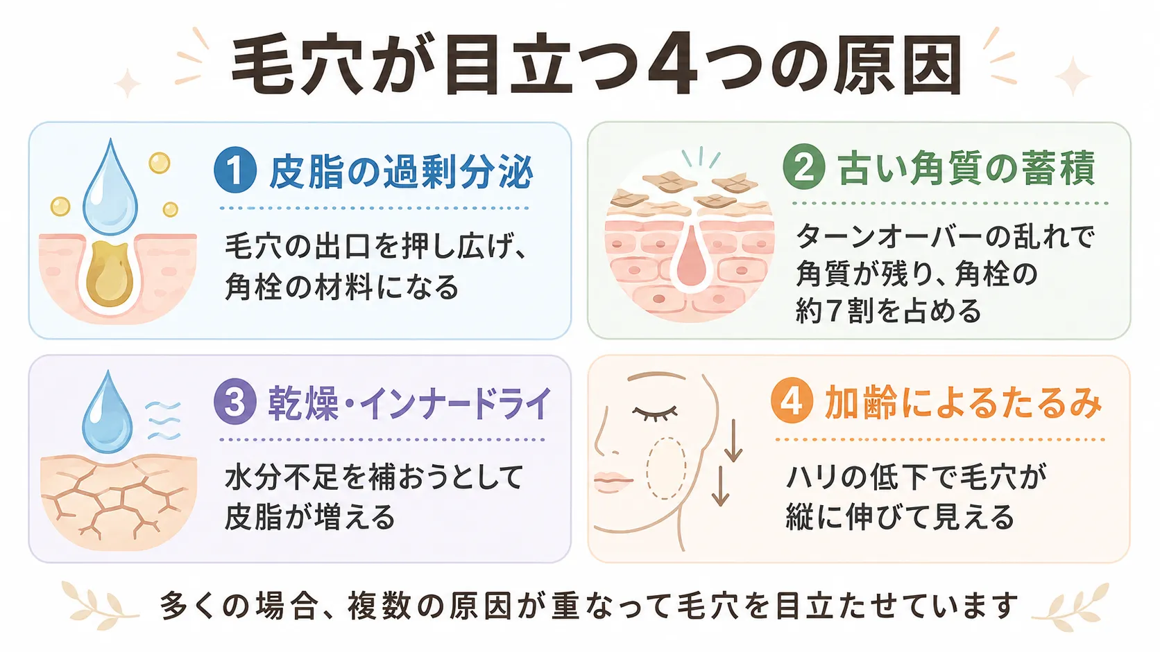 毛穴が目立つ4つの原因を示す図。皮脂の過剰分泌、古い角質の蓄積、乾燥・インナードライ、加齢によるたるみを紹介。