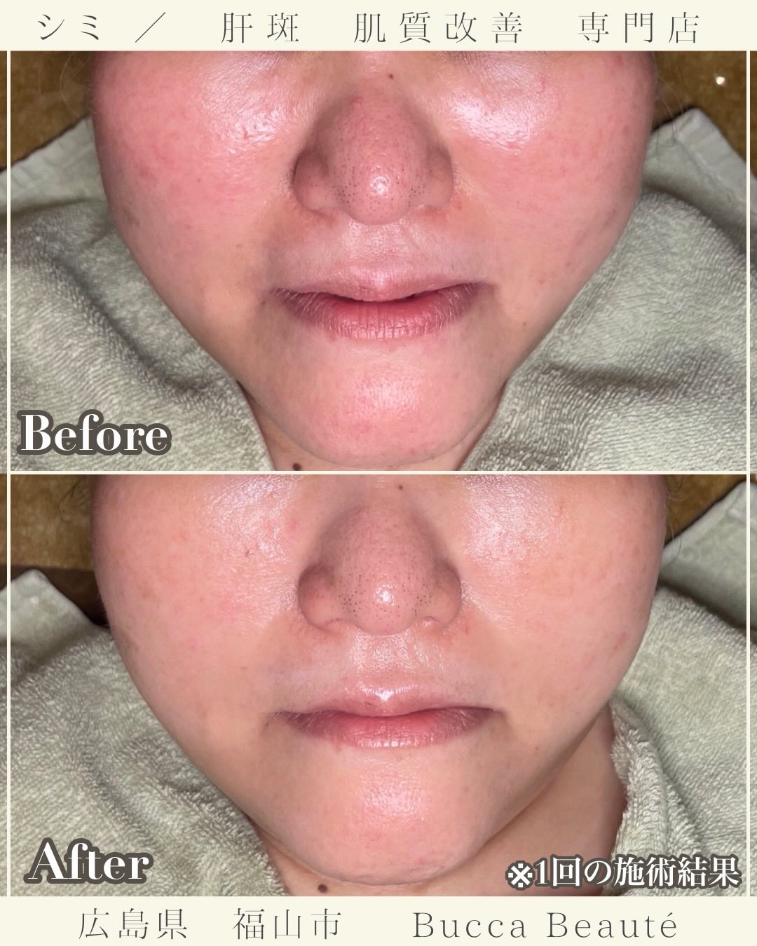 実際の改善事例:1ヶ月後も効果が持続