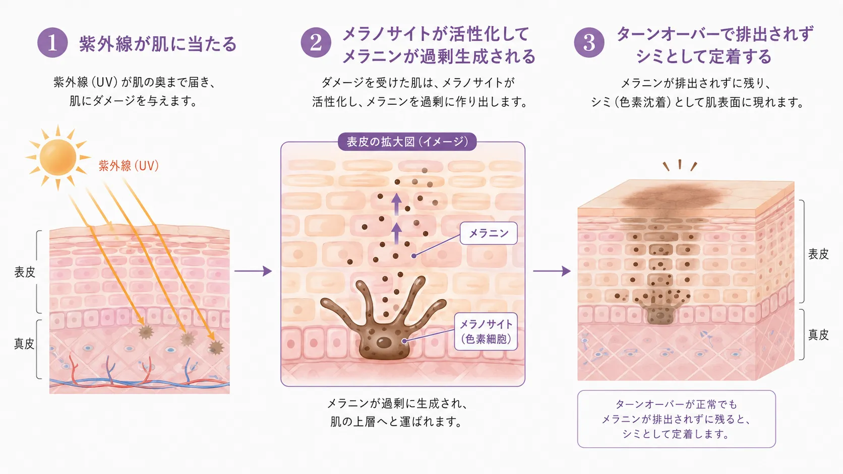 紫外線がシミを作る仕組みを示す図。①紫外線が肌に当たる②メラノサイトが活性化してメラニンが過剰生成される③ターンオーバーで排出されずシミとして定着する、の3ステップを図解。
